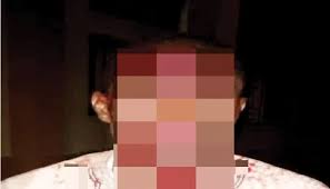 In Bauchi, a man attacks a doctor with an axe over the treatment of his pregnant niece.