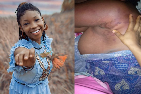 ‘I must speak up to stop my mother from becoming like Osinachi’, Lady who cries out for assistance for her mother who has been the victim of domestic abuse.