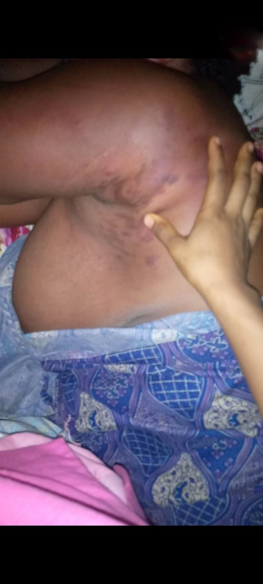 ‘I must speak up to stop my mother from becoming like Osinachi’, Lady  who cries out for assistance for her mother who has been the victim of domestic abuse.	